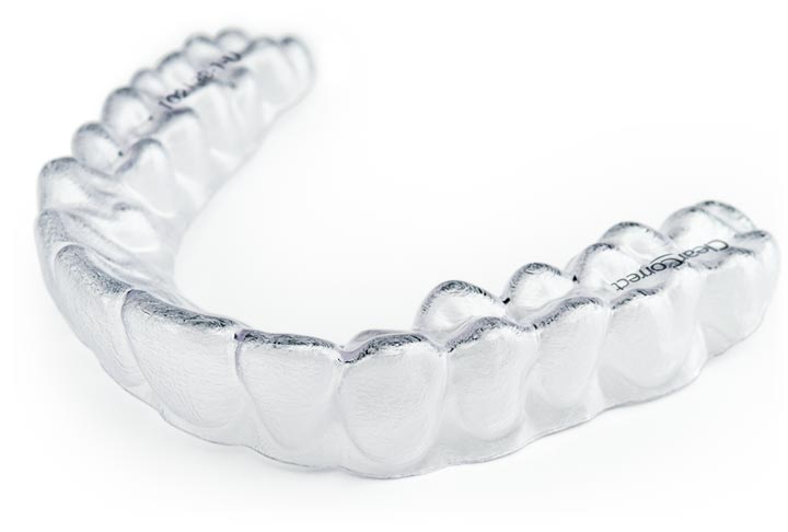 Clear Braces: Transform Your Smile | Divine Dental Spa, El Paso
