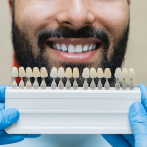 Whitening concept. Dental care, implants for veneers. Beautiful Middle-Eastern man with perfect smile choosing teeth tooth tone at dental clinic.