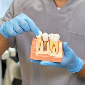 Unlock Your Perfect Smile: Divine Dental Spa, Your Premier Choice for Expert Dental Care in El Paso