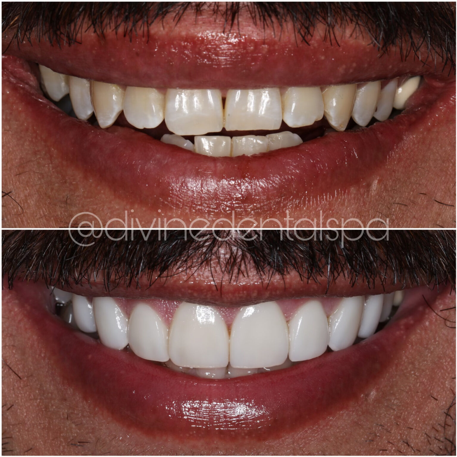 Divine Dental Spa Expert Dental Care for Perfect Smile, El Paso