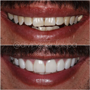 Divine Dental Spa: Expert Dental Care for Perfect Smile, El Paso