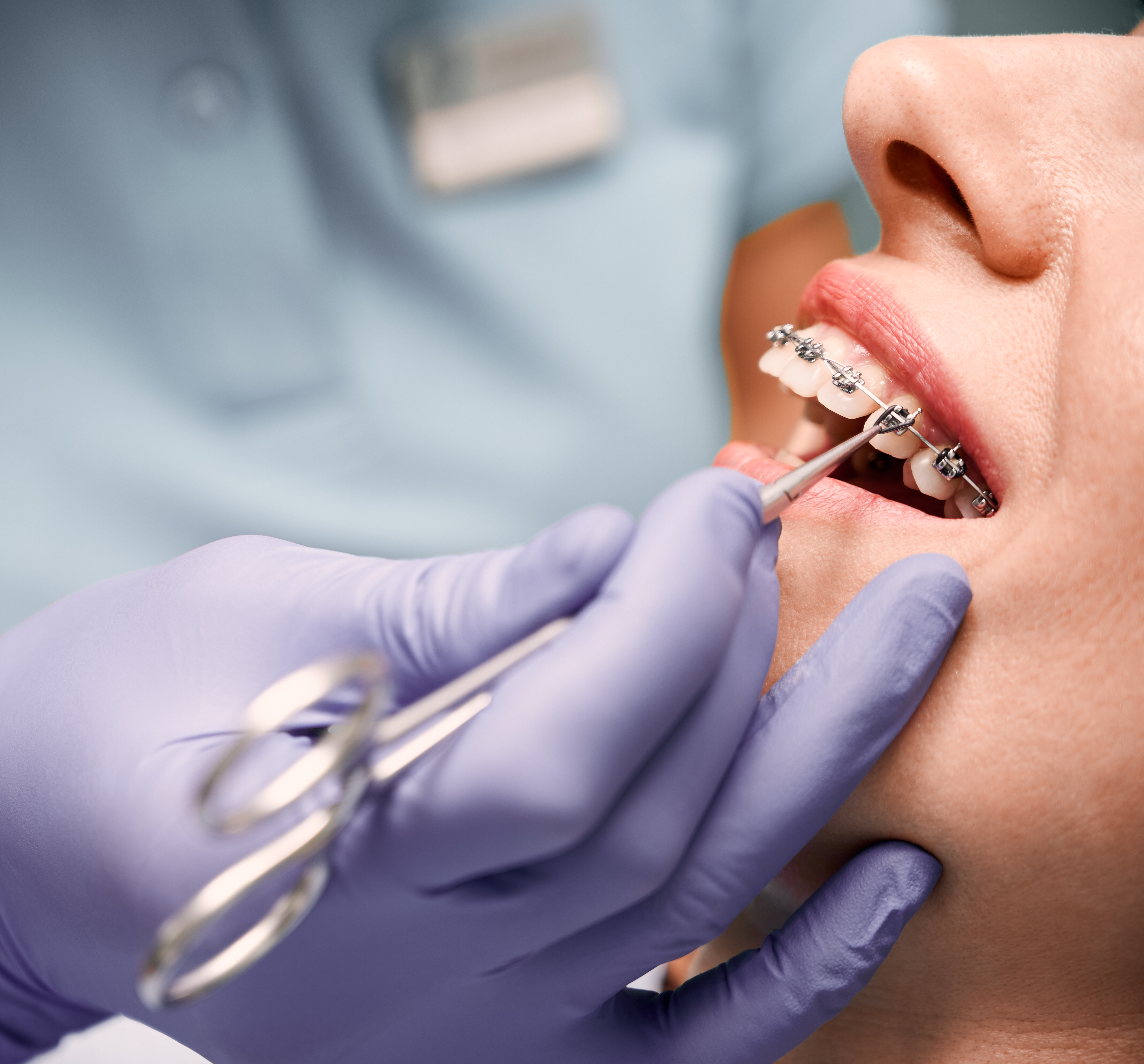 Orthodontist El Paso
