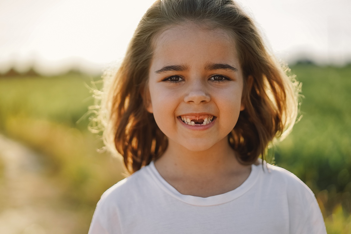 Affordable Dental Implants Divine Dental Spa El Paso, TX