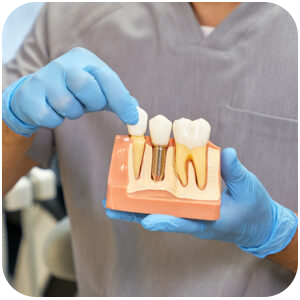 Dental Implants and Root Planing Procedures at Divine Dental Spa in El Paso